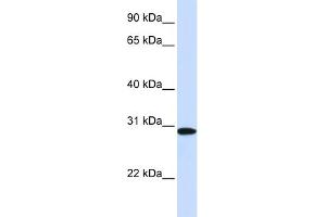 WB Suggested Anti-MTHFD2 Antibody Titration:  0. (MTHFD2 Antikörper  (N-Term))