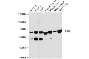 Western blot analysis of extracts of various cell lines, using PKLR antibody (ABIN6128469, ABIN6145710, ABIN6145712 and ABIN6215656) at 1:3000 dilution. (PKLR Antikörper  (AA 446-556))