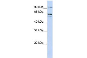 WB Suggested Anti-ABCE1 Antibody Titration:  0. (ABCE1 Antikörper  (C-Term))