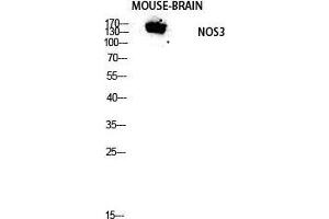 Western Blot (WB) analysis of Mouse Brain lysis using NOS3 antibody. (ENOS Antikörper  (Thr180, Tyr182))