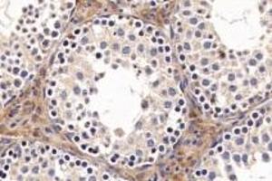Immunohistochemistry analysis of paraffin-embedded mouse testis using ACE (ABIN7073050) at dilution of 1: 1000 (Angiotensin Converting Enzyme 1 Antikörper)