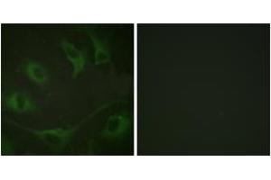 Immunofluorescence analysis of A549 cells, using CBL (Phospho-Tyr774) Antibody. (CBL Antikörper  (pTyr774))