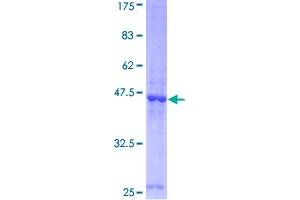 Image no. 1 for Lipocalin 2 (LCN2) (AA 1-198) protein (GST tag) (ABIN1309238)