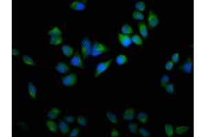 Immunofluorescence staining of Hela cells with ABIN7164629 at 1:100, counter-stained with DAPI. (USP9X Antikörper  (C-Term))