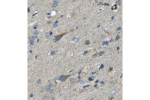 IHC analysis of Nefh using anti-Nefh antibody (ABIN7599700).