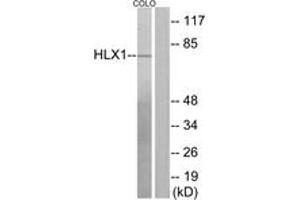 Western blot analysis of extracts from COLO205 cells, using HLX1 Antibody. (HLX Antikörper  (AA 321-370))