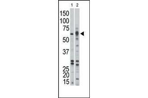 The anti-ACVR1B Pab (ABIN392232 and ABIN2841926) is used in Western blot to detect ACVR1B in Jurkat (1) and mouse kidney (2) tissue lysates. (Activin A Receptor Type IB/ALK-4 Antikörper  (AA 134-164))