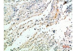 Immunohistochemical analysis of paraffin-embedded human-brain, antibody was diluted at 1:200 (Versican Antikörper  (AA 2530-2580))