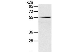 Western Blot analysis of Mouse pancreas tissue using SLC16A10 Polyclonal Antibody at dilution of 1:200 (SLC16A10 Antikörper)
