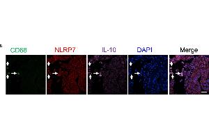 NLRP7 is predominantly expressed in decidual M2 macrophages (CD68+/IL-10+) in the human endometrium of the pregnant uterus. (IL-10 Antikörper  (AA 101-178))