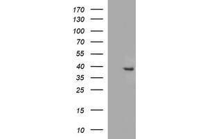 Image no. 1 for anti-Fatty Acid 2-Hydroxylase (FA2H) antibody (ABIN1500828) (FA2H Antikörper)