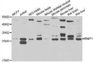 Western blot analysis of extracts of various cell lines, using BNIP1 antibody. (BNIP1 Antikörper)