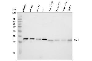 Western blot analysis of NM23A/NME1 using anti-NM23A/NME1 antibody (ABIN3043572).