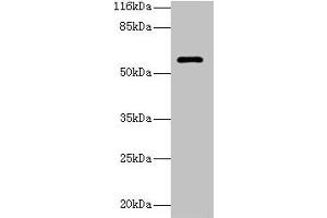 Western blot All lanes: GK3P antibody at 2 μg/mL + Hela whole cell lysate Secondary Goat polyclonal to rabbit IgG at 1/10000 dilution Predicted band size: 61 kDa Observed band size: 61 kDa (GK3P Antikörper  (AA 1-220))