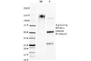 SDS-PAGE Analysis of Purified CTLA4 Mouse Monoclonal Antibody (L4P2F5. (CTLA4 Antikörper)
