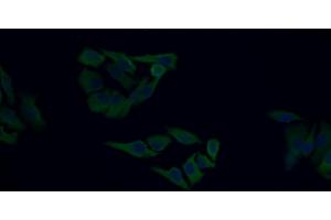 Detection of IGF1 in Human HepG2 cell using Monoclonal Antibody to Insulin Like Growth Factor 1 (IGF1) (IGF1 Antikörper  (AA 49-118))
