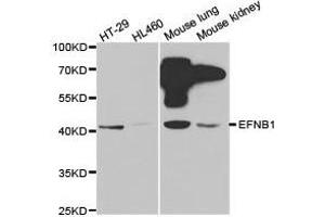Western Blotting (WB) image for anti-Ephrin B1 (EFNB1) antibody (ABIN1872442) (Ephrin B1 Antikörper)