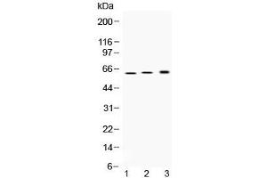 Western Blotting (WB) image for anti-ATPase, H+/K+ Exchanging, beta Polypeptide (ATP4b) (AA 1-28) antibody (ABIN5647655)
