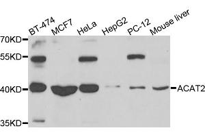 Western blot analysis of extracts of various cell lines, using ACAT2 antibody (ABIN5975212) at 1/1000 dilution. (ACAT2 Antikörper)