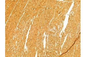 ABIN6263423 and ABIN6273058 at 1/100 staining Rat heart tissue by IHC-P. (MTO1 Antikörper  (N-Term))