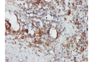 Immunostaining (ISt) image for anti-Signal Transducer and Activator of Transcription 4 (STAT4) (AA 1-748) antibody (ABIN563030)