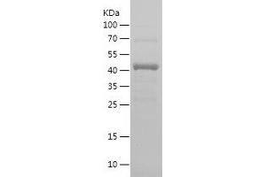 Western Blotting (WB) image for Methyltransferase Like 3 (METTL3) (AA 397-580) protein (His-IF2DI Tag) (ABIN7123947) (METTL3 Protein (AA 397-580) (His-IF2DI Tag))