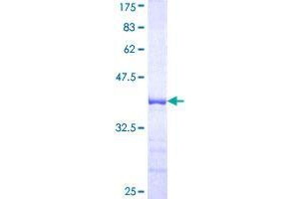 USP12 Protein (AA 69-168) (GST tag)