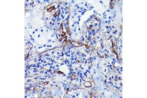 Immunohistochemistry (IHC) image for anti-Endoglin (ENG) antibody (ABIN7266938)
