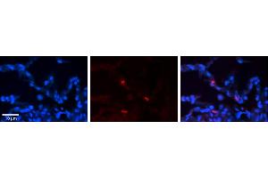Rabbit Anti-FCGRT Antibody     Formalin Fixed Paraffin Embedded Tissue: Human Lung Tissue  Observed Staining: Membrane and cytoplasmic in alveolar type I cells  Primary Antibody Concentration: 1:100  Other Working Concentrations: 1/600  Secondary Antibody: Donkey anti-Rabbit-Cy3  Secondary Antibody Concentration: 1:200  Magnification: 20X  Exposure Time: 0. (FcRn Antikörper  (N-Term))
