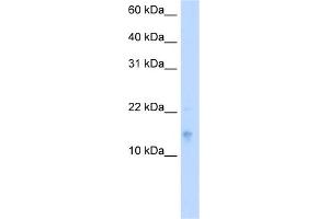 WB Suggested Anti-VAMP5 Antibody Titration:  5. (VAMP5 Antikörper  (Middle Region))
