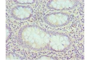 Immunohistochemistry of paraffin-embedded human epityphlon tissue using ABIN7152160 at dilution of 1:100 (EIF3H Antikörper  (AA 80-340))