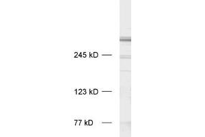 dilution: 1 : 1000, sample: rat brain homogenate (MAP2 Antikörper  (AA 2-309))
