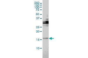 TRAPPC2 monoclonal antibody (M01), clone 2E10 Western Blot analysis of TRAPPC2 expression in Hela . (TRAPPC2 Antikörper  (AA 1-140))