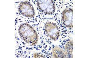 Immunohistochemistry of paraffin-embedded human colon using GTF2F2 antibody (ABIN6131726, ABIN6141494, ABIN6141496 and ABIN6217519) at dilution of 1:200 (40x lens). (GTF2F2 Antikörper  (AA 1-249))