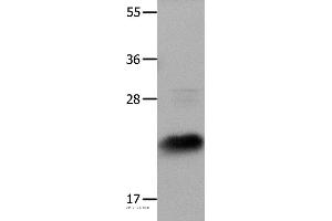 Western blot analysis of Hela cells, using IL18 Polyclonal Antibody at dilution of 1:1350 (IL-18 Antikörper)