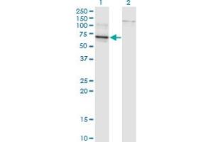 Western Blotting (WB) image for anti-T-Box 22 (TBX22) (AA 431-519) antibody (ABIN526383)