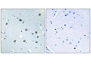Immunohistochemistry analysis of paraffin-embedded human brain tissue using MYO1D antibody.