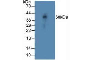 Detection of NOTCH4 in Rat Vein Tissue using Polyclonal Antibody to Notch Homolog 4 (NOTCH4) (NOTCH4 Antikörper  (AA 1715-2001))