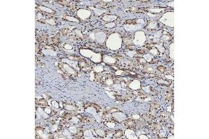 IHC analysis of mSin3A/SIN3A using anti-mSin3A/SIN3A antibody (ABIN7602504). (SIN3A Antikörper  (AA 8-918))