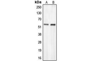 Western blot analysis of CHST2 expression in HepG2 (A), COLO205 (B) whole cell lysates.
