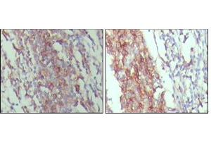 Immunohistochemical analysis of paraffin-embedded human lymph node tissue,showing membrane and cytoplasmic localization with DAB staining using CD45 mouse mAb. (CD45 Antikörper)