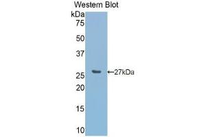 Detection of recombinant CA5A using Polyclonal Antibody to Carbonic Anhydrase VA (CA5A) (CA5A Antikörper  (AA 12-219))