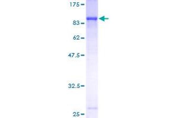 ECM1 Protein (AA 1-540) (GST tag)