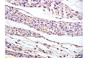 Formalin-fixed and paraffin embedded mouse embryo labeled with Anti-PAP2B Polyclonal Antibody, Unconjugated (ABIN754228) at 1:200 followed by conjugation to the secondary antibody and DAB staining (PPAP2B Antikörper  (AA 241-311))