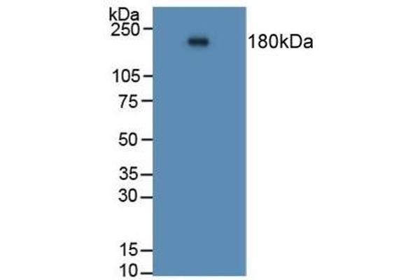 Angiotensin I Converting Enzyme 1 Antikörper  (AA 814-1071)