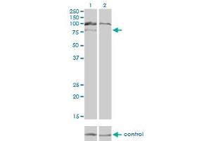 Western blot analysis of HGS over-expressed 293 cell line, cotransfected with HGS Validated Chimera RNAi (Lane 2) or non-transfected control (Lane 1). (HGS Antikörper  (AA 513-612))