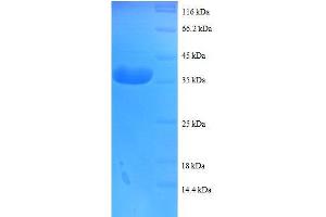 SDS-PAGE (SDS) image for Cytochrome C Oxidase Subunit Vb (COX5B) (AA 32-129), (full length) protein (GST tag) (ABIN1608023)
