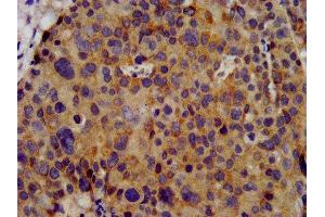 Immunohistochemistry (IHC) image for anti-Potassium Voltage-Gated Channel, Shaw-Related Subfamily, Member 3 (KCNC3) (AA 638-745) antibody (ABIN7163969)