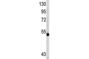 Western blot analysis of MYCN antibody and CEM lysate (MYCN Antikörper  (AA 322-351))