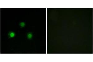 Immunofluorescence analysis of HuvEc cells, using MSH2 Antibody. (MSH2 Antikörper  (AA 541-590))
